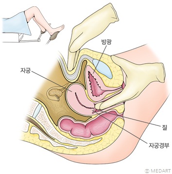 내진을 받을 때 자세와 내진 방법