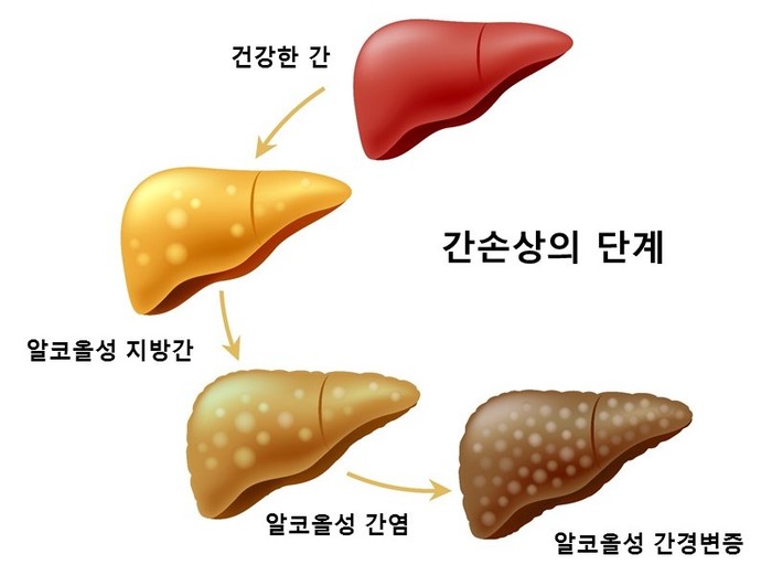 간손상의 단계