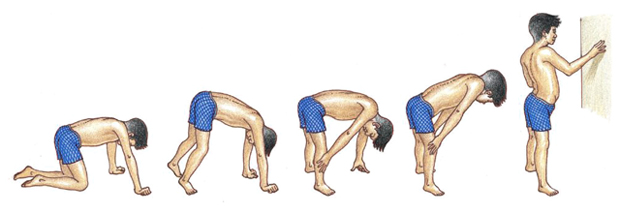 근육병 환자의 일어서는 동작