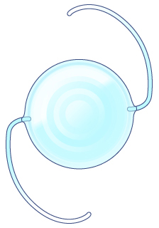 다초점 인공수정체