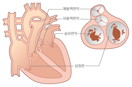 심장판막의 종류