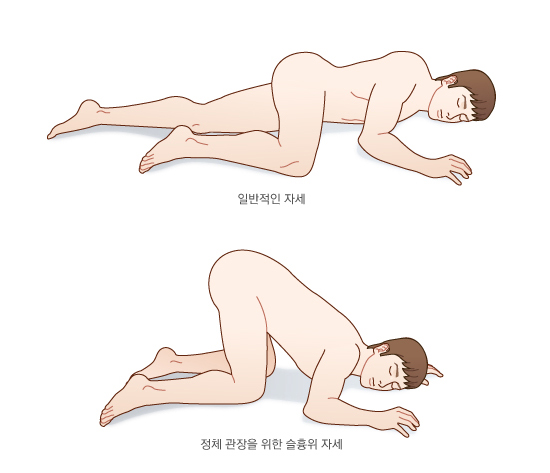 관장하는 자세