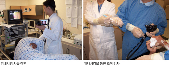 위내시경 시술 장면