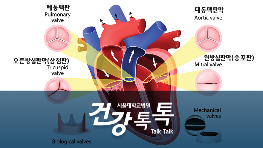 [건강톡톡][164편]<!HS>심장<!HE> <!HS>판막<!HE>과 승모<!HS>판막<!HE> 폐쇄부전증